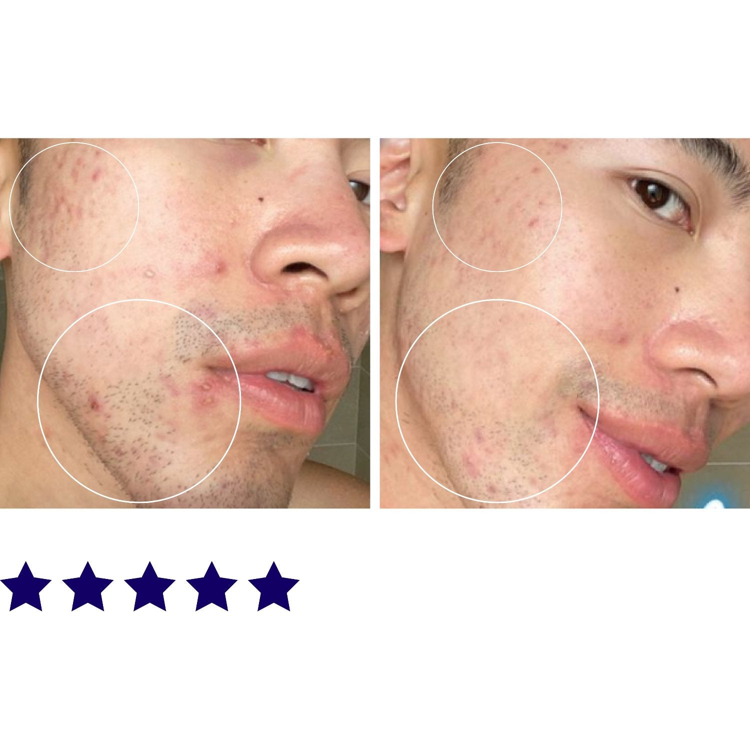 &quot;Love it! Two weeks and my skin is clearer and visibly healthier looking.&quot;